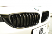 BMW 4シリーズ 420iｸﾞﾗﾝｸｰﾍﾟ Mｽﾎﾟｰﾂ LCI後期 ﾋｰﾀｰ付茶革 追従ACC 液晶ﾒｰﾀｰ ﾍｷｻｺﾞﾅﾙLEDﾍｯﾄﾞﾗｲﾄ&ﾃｰﾙ ﾌﾞﾗｯｸｷﾄﾞﾆｰｸﾞﾘﾙ 車線変更&逸脱&歩行者警告 衝突軽減B ﾀｯﾁﾊﾟﾈﾙ付iﾄﾞﾗｲﾌﾞHDDﾅﾋﾞBｶﾒﾗ 電動ﾘｱｹﾞｰﾄ 18AW 2年保証
